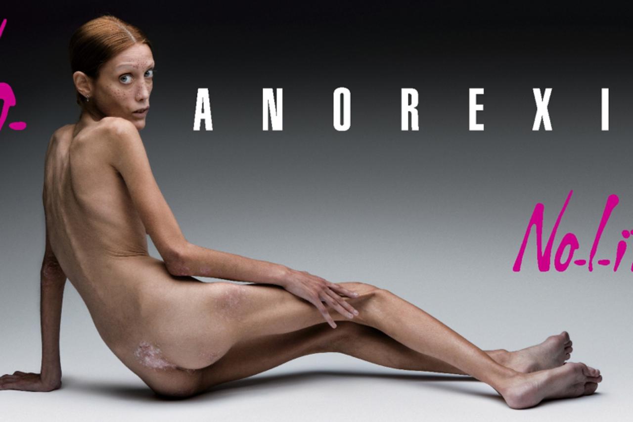 anoreksija (1)