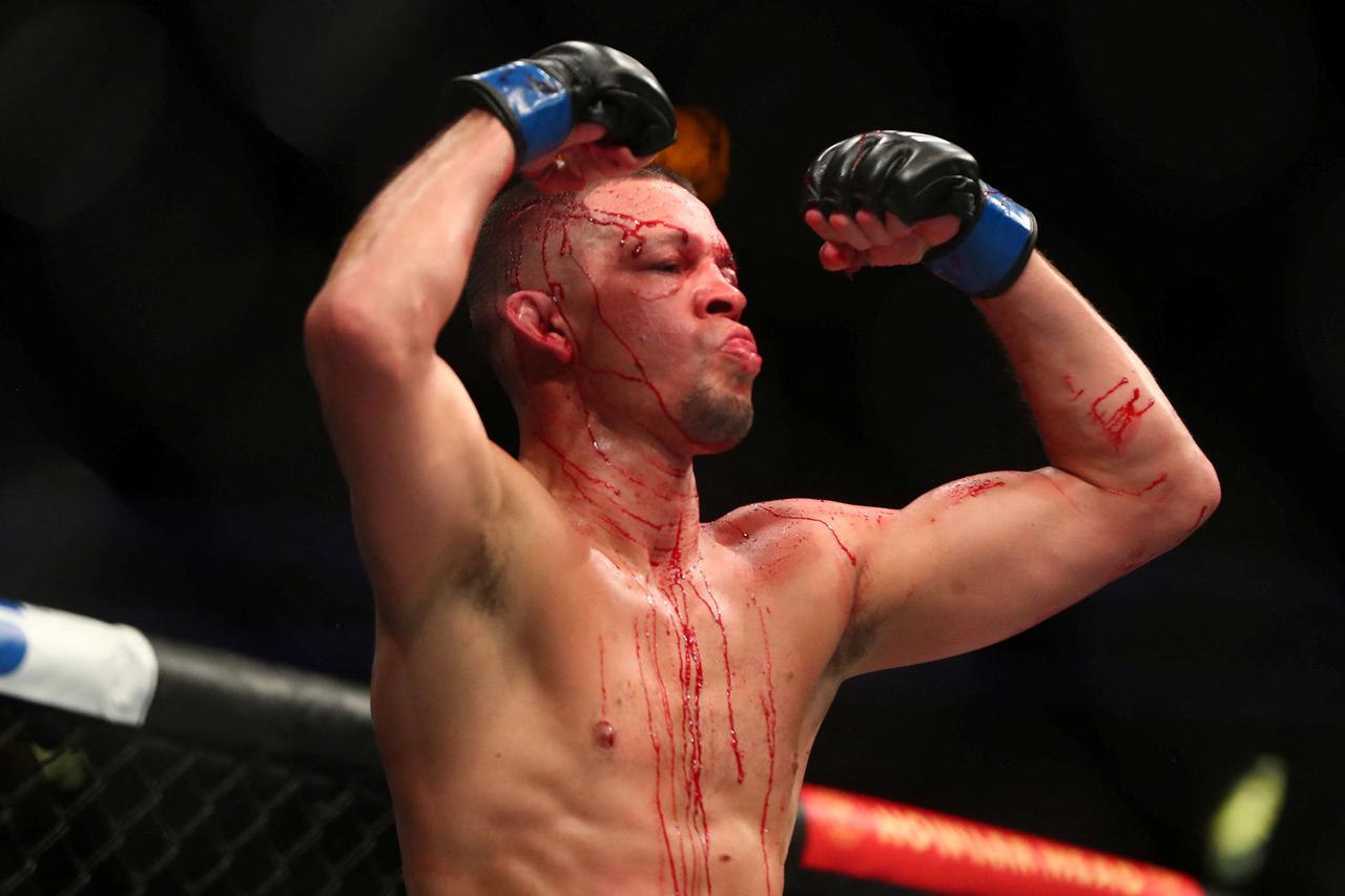 FILE PHOTO: MMA: UFC 263-Diaz vs Edwards
