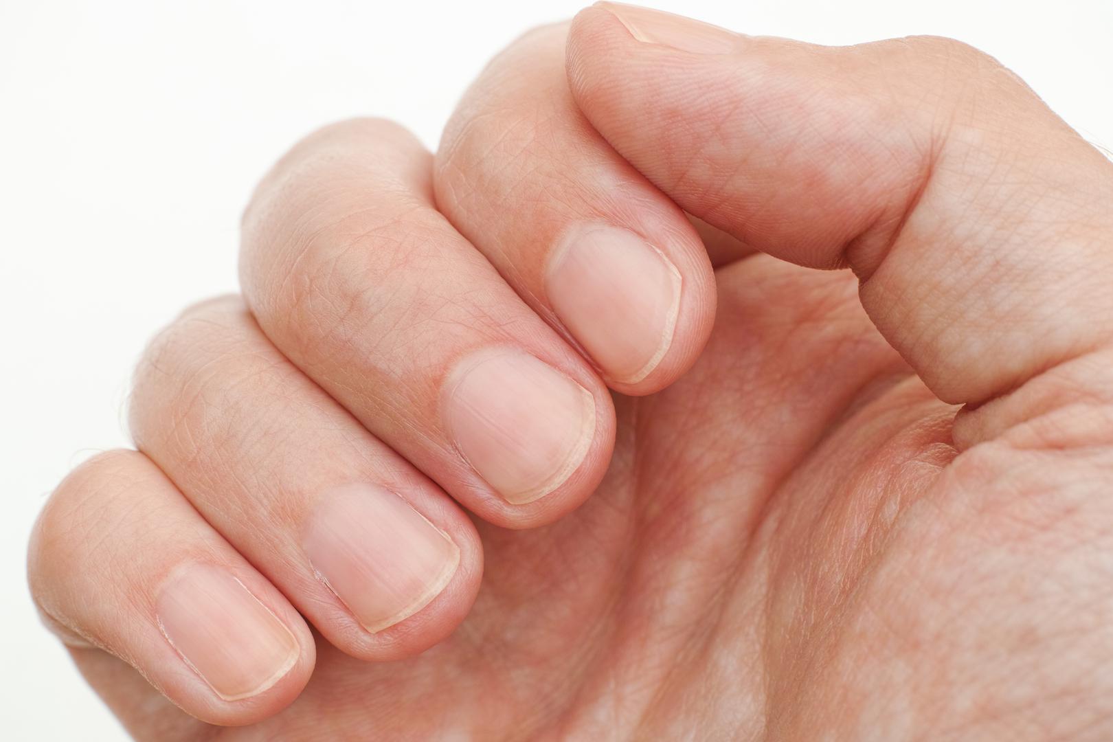 7. Provjerite svoje nokte: Možda ne mislite da vaši nokti mogu previše odati u vezi s vašim zdravljem, međutim, dr. Wild kaže da promjene u izgledu vaših noktiju mogu istaknuti temeljno zdravstveno stanje. Objašnjava: ‘Ako niste ozlijedili nokat i primijetite promjene boje, udubljenja, izbočine ili da oni postaju lomljivi, obratite se liječniku. Bijele mrlje također mogu ukazivati ​​na zdravstveno stanje ako osjetite druge simptome uz promjene na noktima, poput osjećaja slabosti, umora, nedostatka daha ili imate zamagljen vid’. 