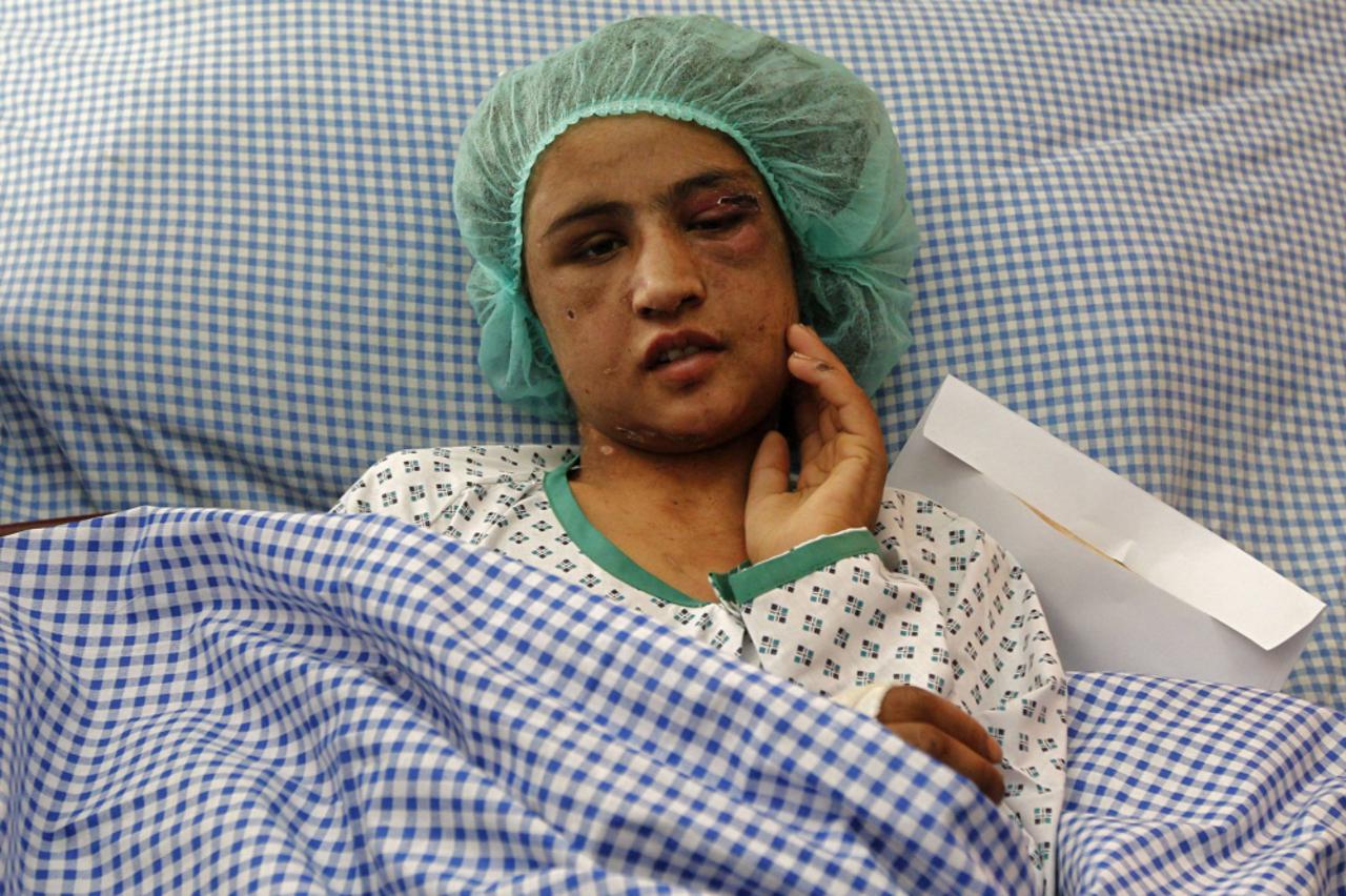Djevojka je sada u bolnici u Kabulu, no bit će prebačena u Indiju