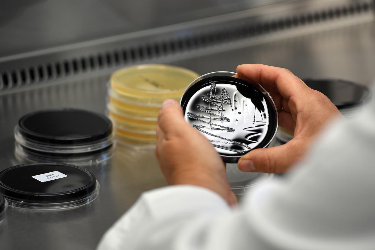 Duesseldorf: Otvoren laboratorij za istraživanje opasne bakterije