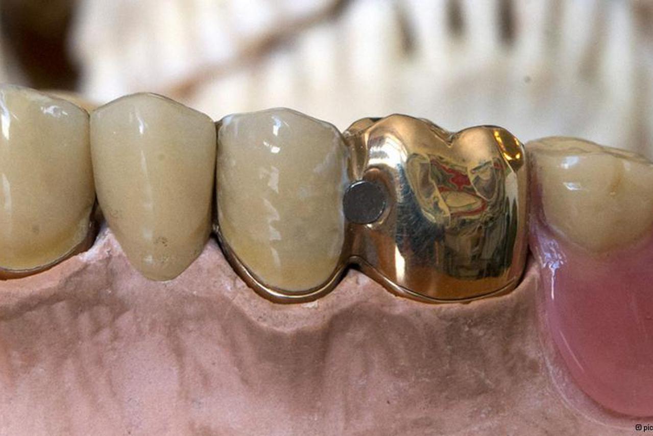 zubno zlato