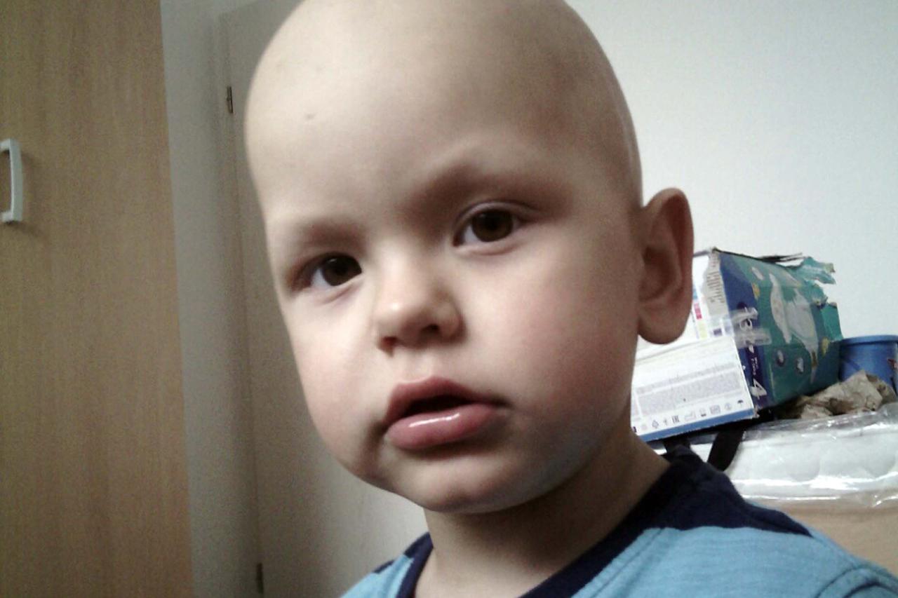 Luka Bunčić (3) tumor na mozgu kemoterapija