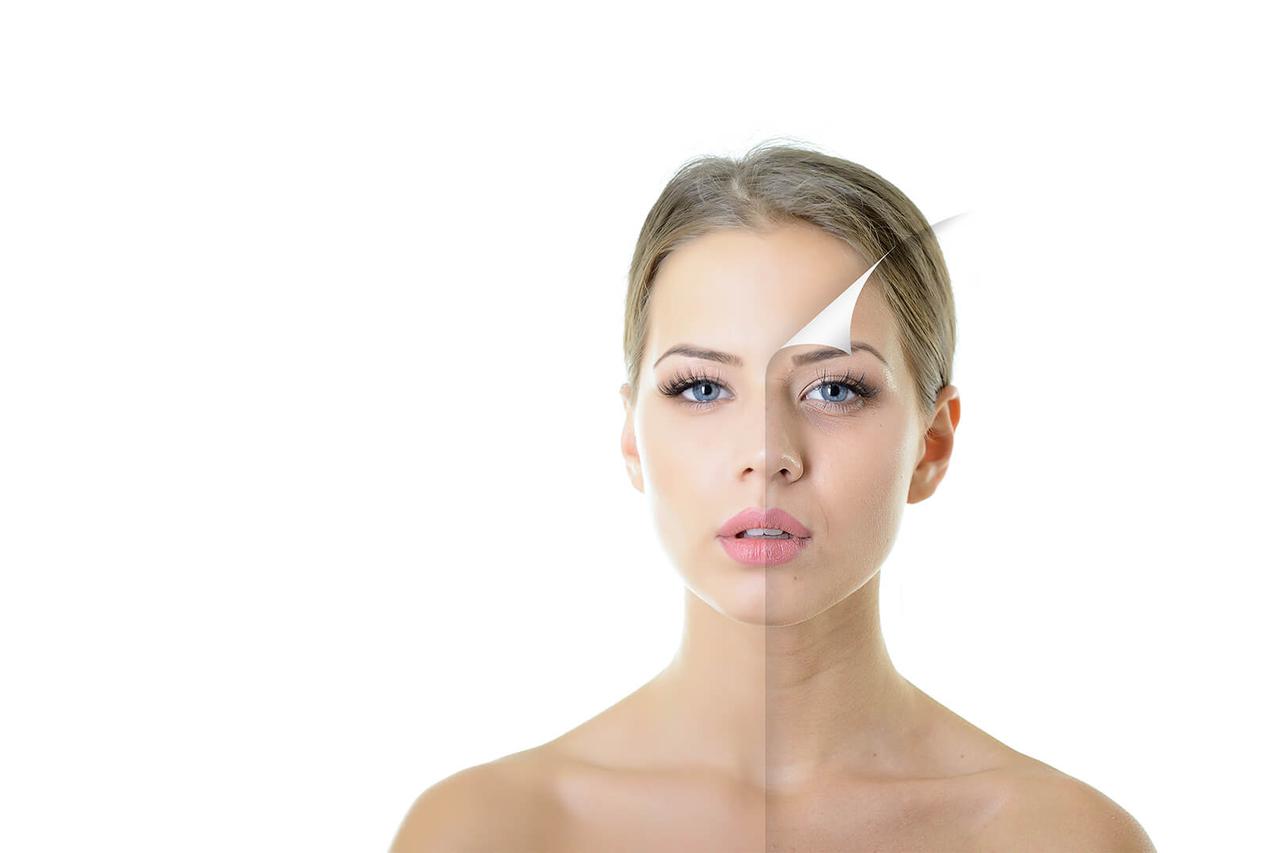 FaceUp - estetski tretman za pomlađivanje lica