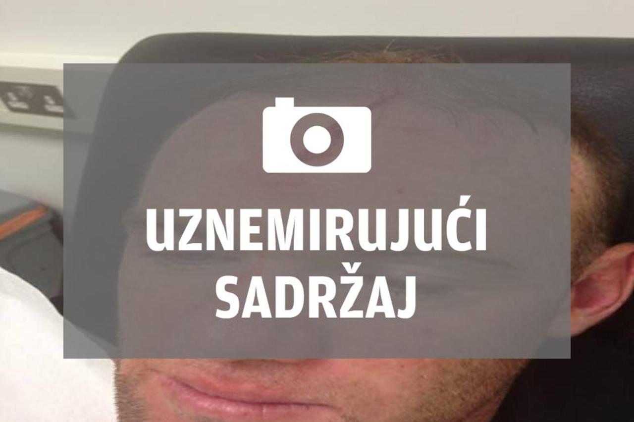 Rooney ozljede