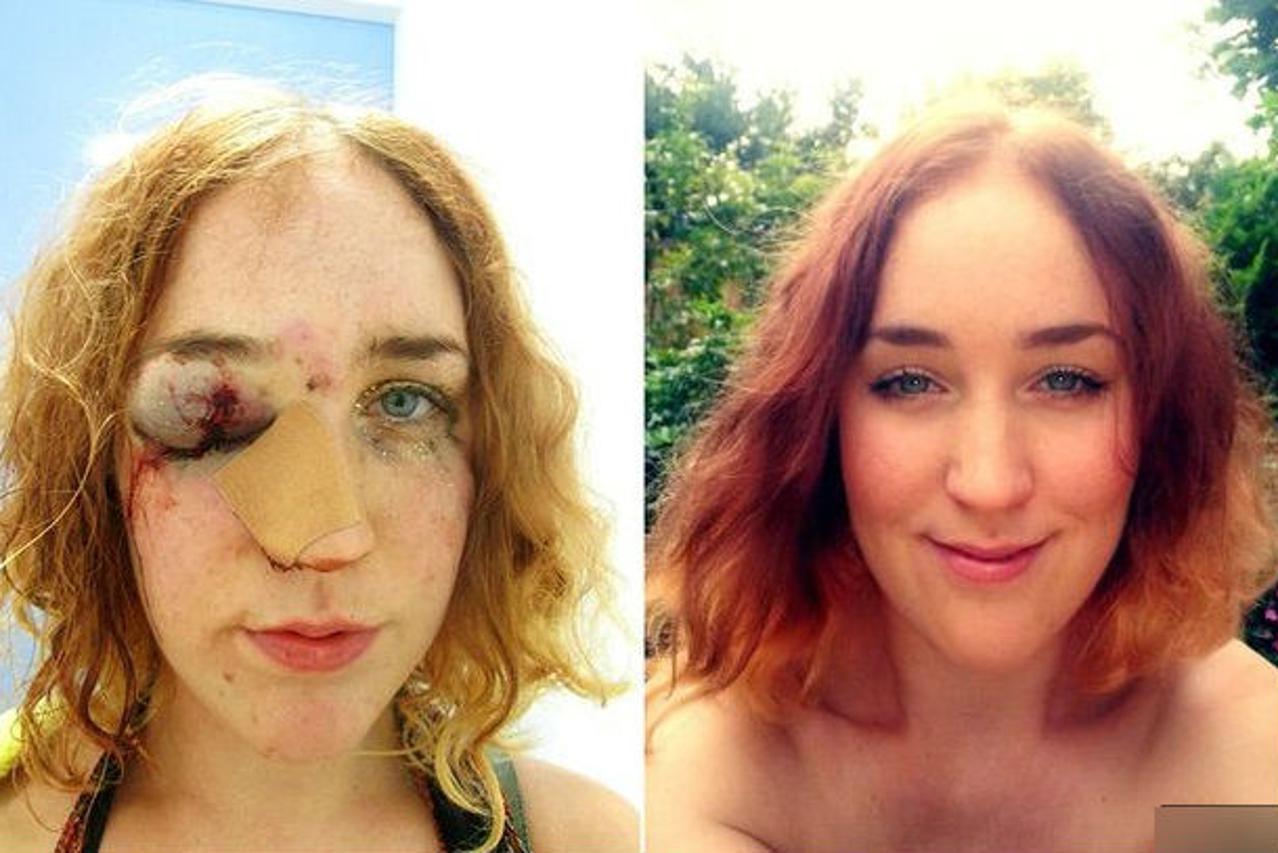 Unakazio joj lice jer je rekla ne