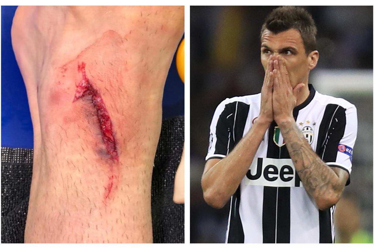 Mario Mandžukić