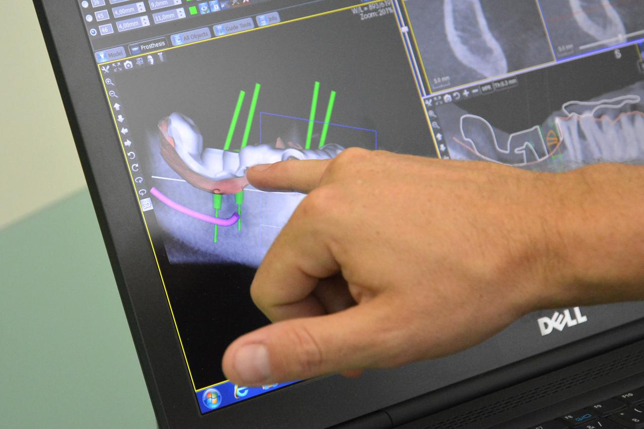 09.06.2015., Krizevci, Trg svetog Florijana - Poliklinika Medikadent d.o.o. je privatni specijalisticki stomatoloski centar temeljen na visoko strucnom i motiviranom osoblju, te najsuvremenijim tehnologijama u dentalnoj medicini uz prisustvo najkvalitetni