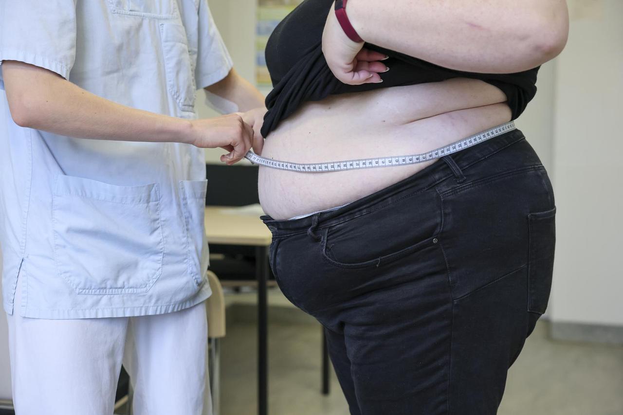 Obesity therapy program