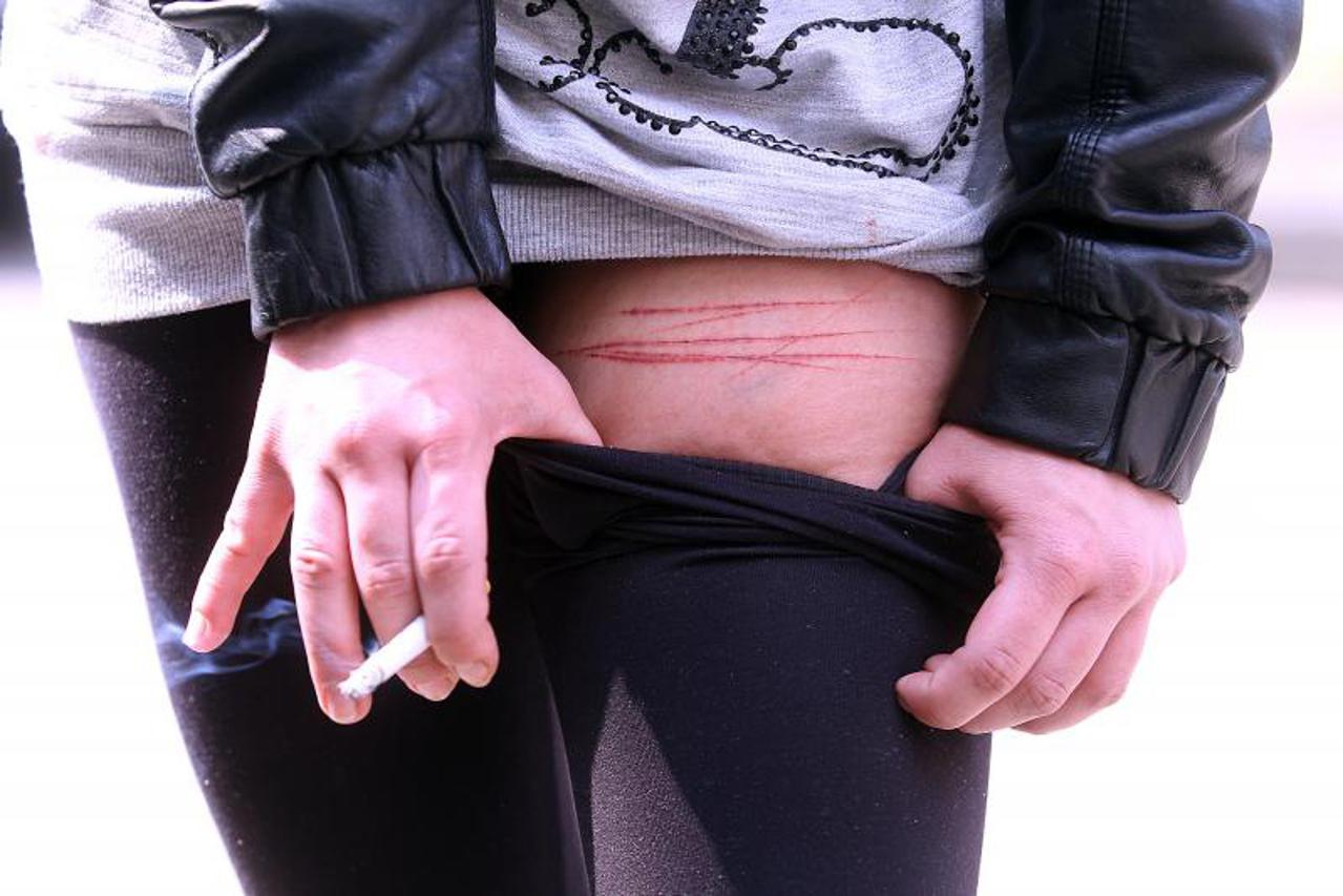 očevid, napad, nož, policija (1)