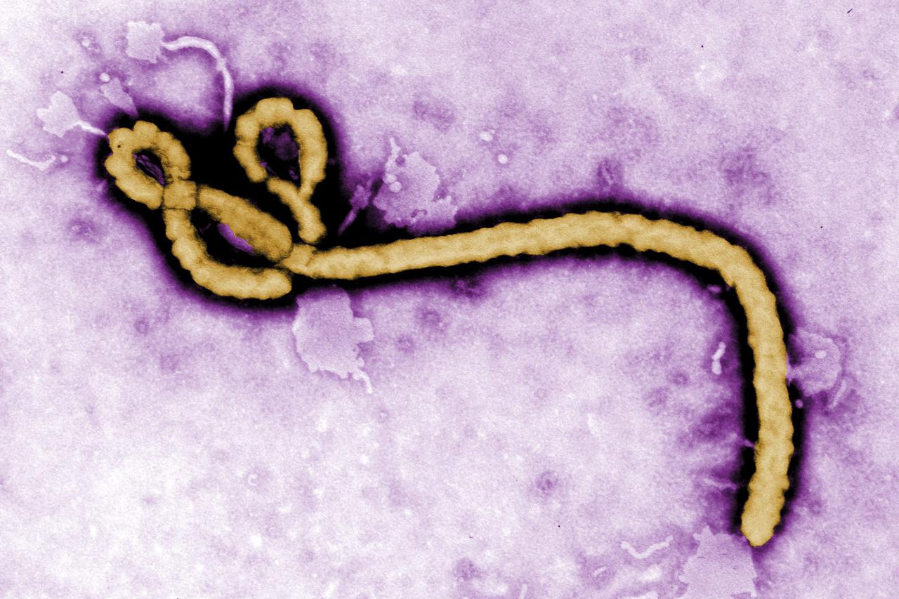 ebola