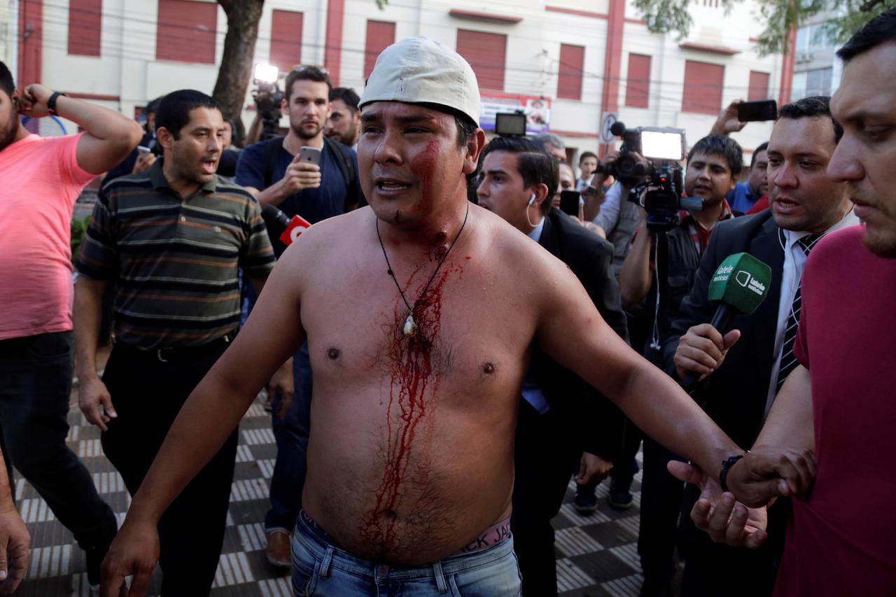 ATTENTION EDITORS - VISUALS COVERAGE OF SCENES OF DEATH OR INJURY A protestor, who is wounded by a rubber bullet in clashes with police during a demonstration against a possible change in law to allow for presidential re-election, stands in front of the C