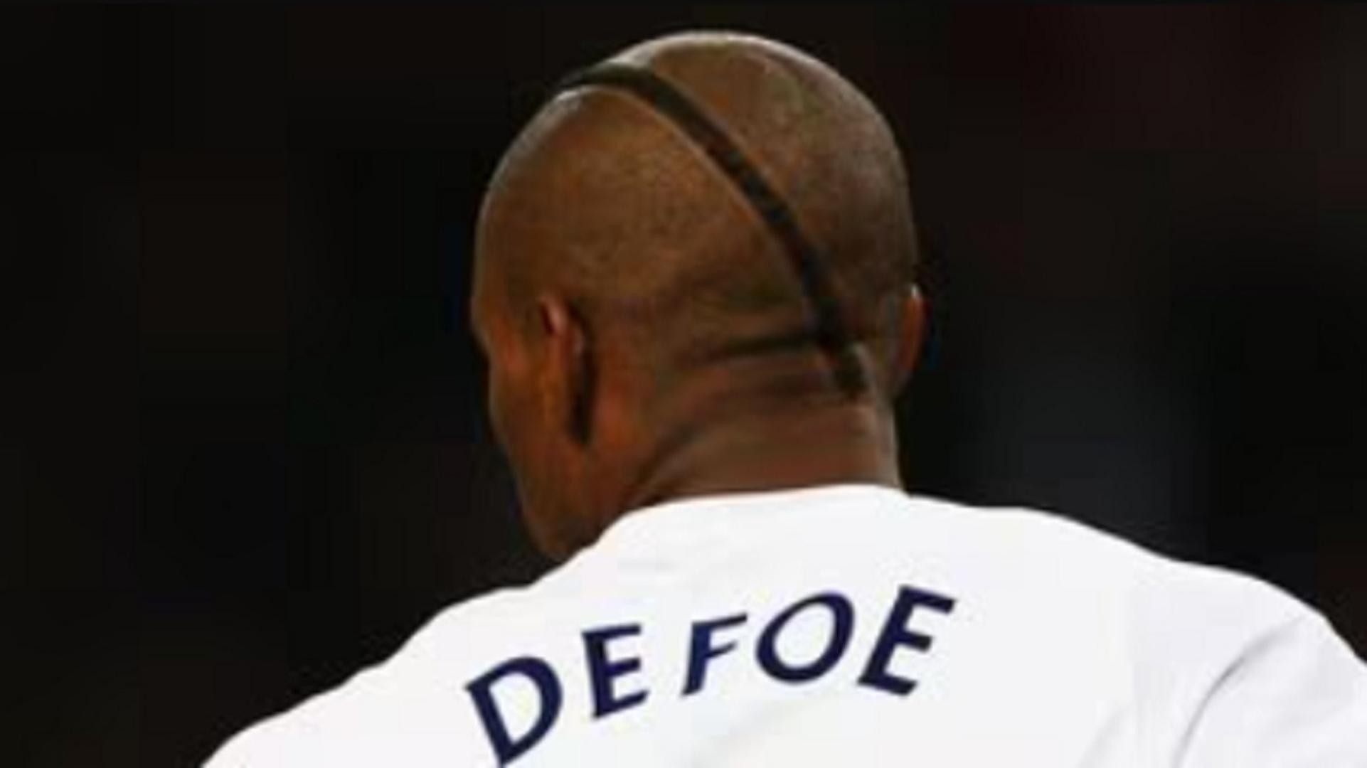 Bivši napadač Tottenhama i engleske reprezentacije, te bivši suigrač Luke Modrića, Jermain Defoe, većinom je u svojoj karijeri bio bez frizure, odnosno ćelav. U jednoj je utakmici, pak, šokirao otočku javnost kad se pojavio s kosom crtom kratke kose nasred glave.