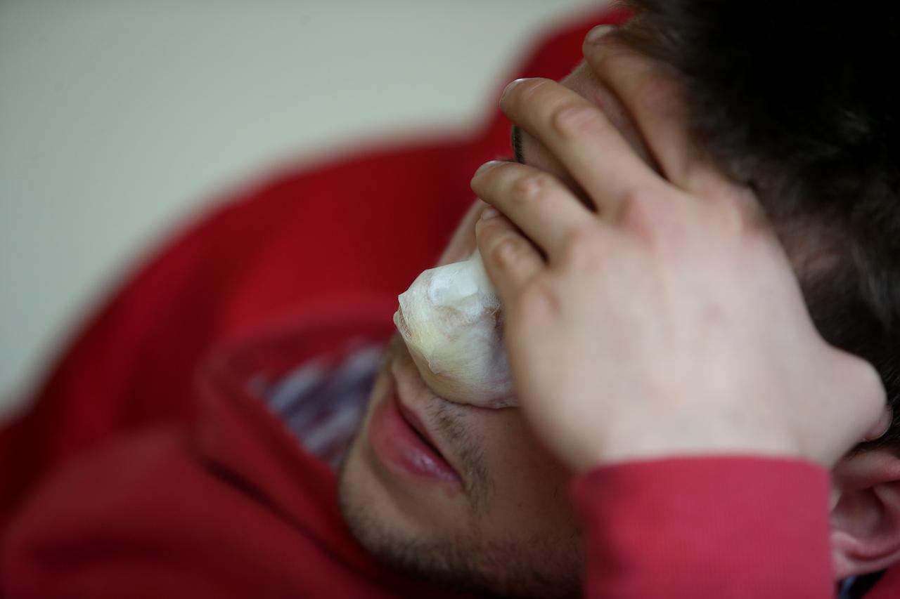 07.04.2015., Zagreb - Pretuceni mladic sa Jaruna u drustvu prijatelja