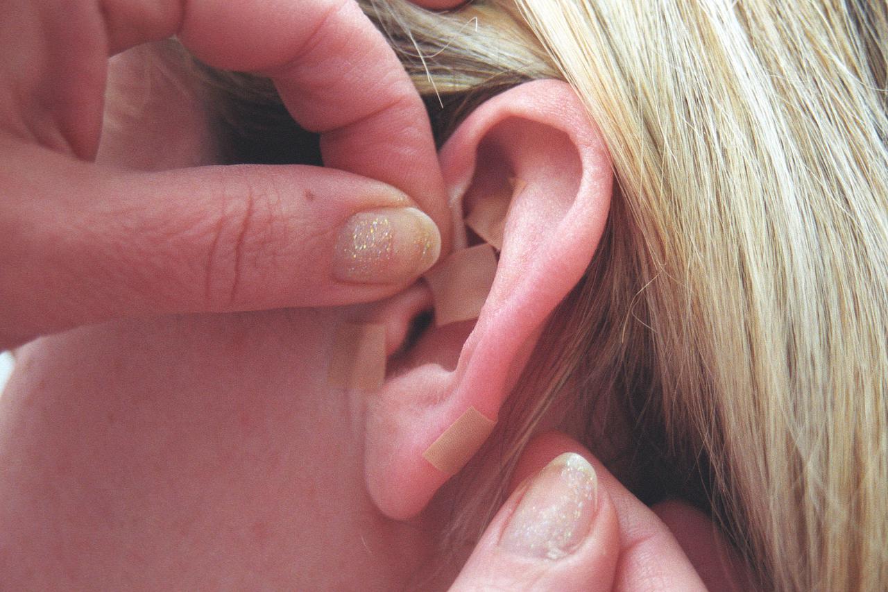 ona...zagreb...25.03.2003. radiceva 17, akupunktura, vesna goricki-pernek foto: goran stanzl