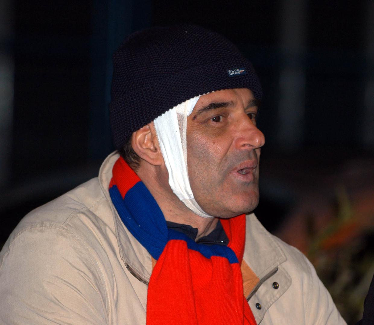 Napadači su ga udarali bejzbol palicama i zadali mu ozbiljnije ozljede glave