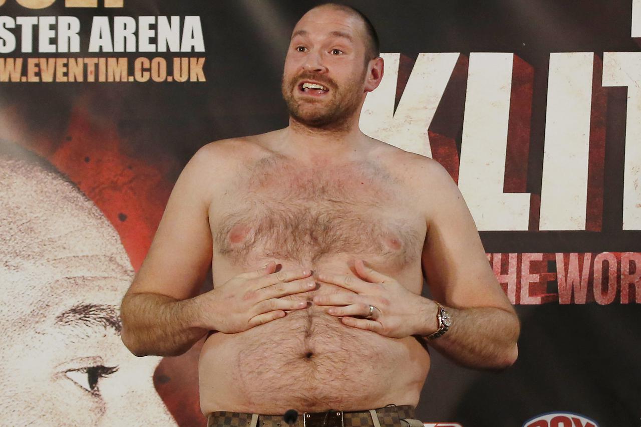 Tyson Fury