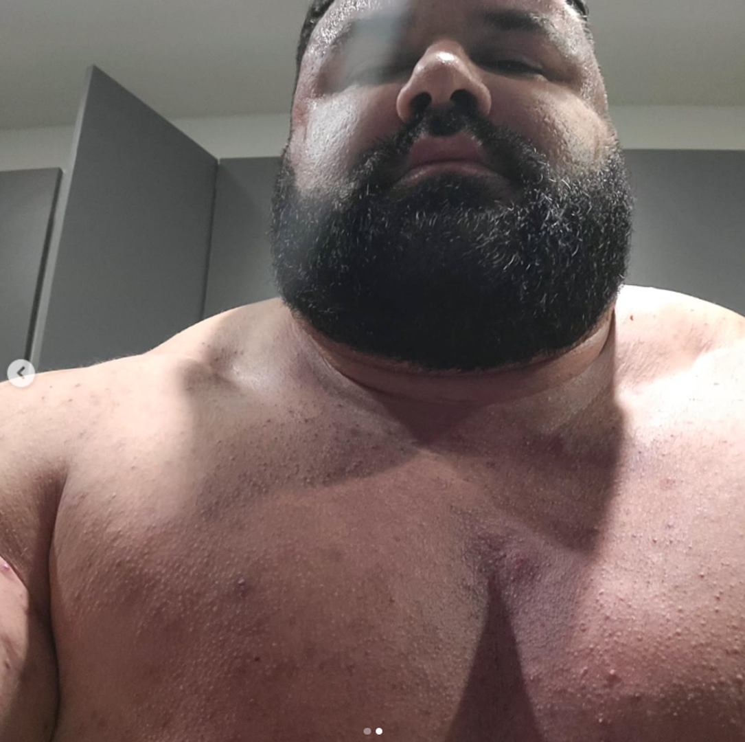 Oporavak od ozljede donio je potpuni zaokret u njegovom režimu. Ervin je prebacio fokus na sirovu snagu i masu, okrenuvši se takozvanom "strongman" stilu vježbanja. Novi pristup rezultirao je ogromnim povećanjem tjelesne težine, koja je dosegla nevjerojatnih 180 kilograma.