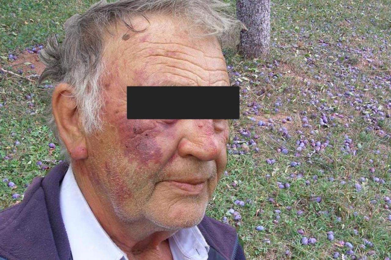 'Starac koji je prije godinu dana pretucen u svom vlastitom dvoristu jer je pokusao otjerati skupinu Roma iz svoga sljivara u kojemu su doticni krali'