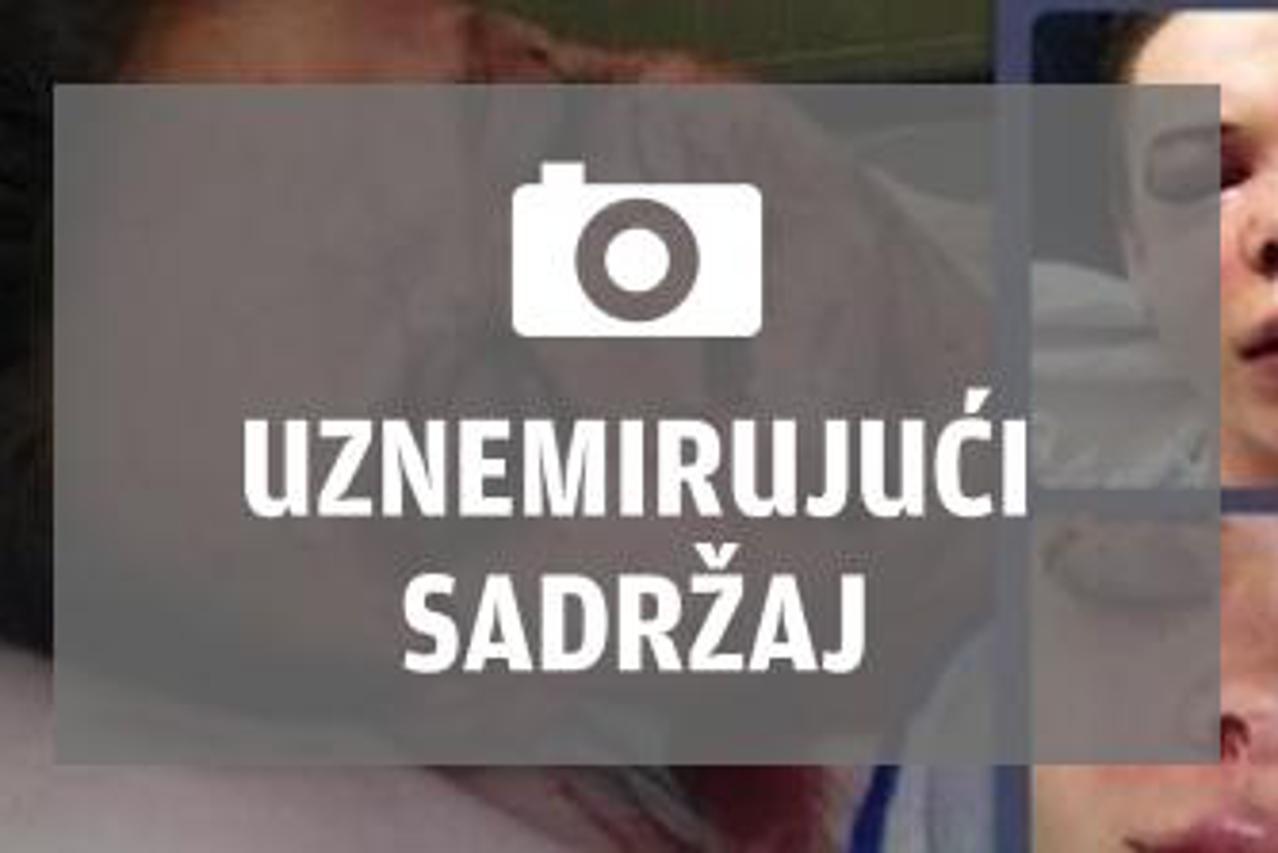 Mallory Owens, pretučena lezbijka