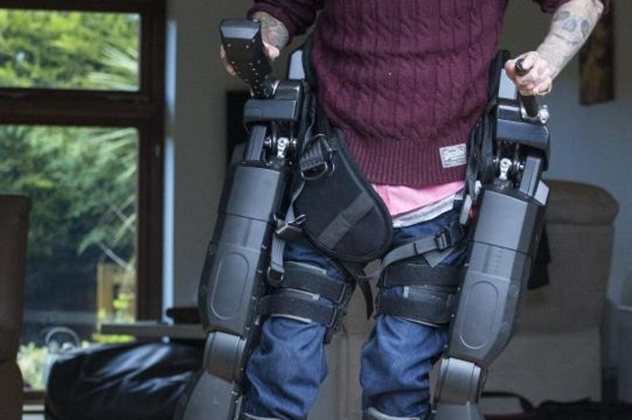 Ben Barnes, bioničke noge