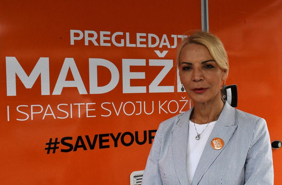 Besplatni pregledi madeža