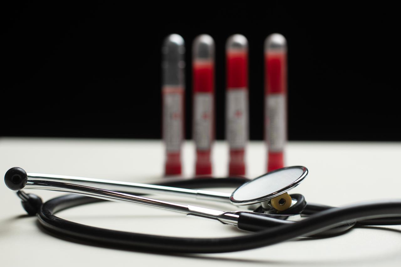 Epruvete s uzorcima krvi - testiranje na koronavirus