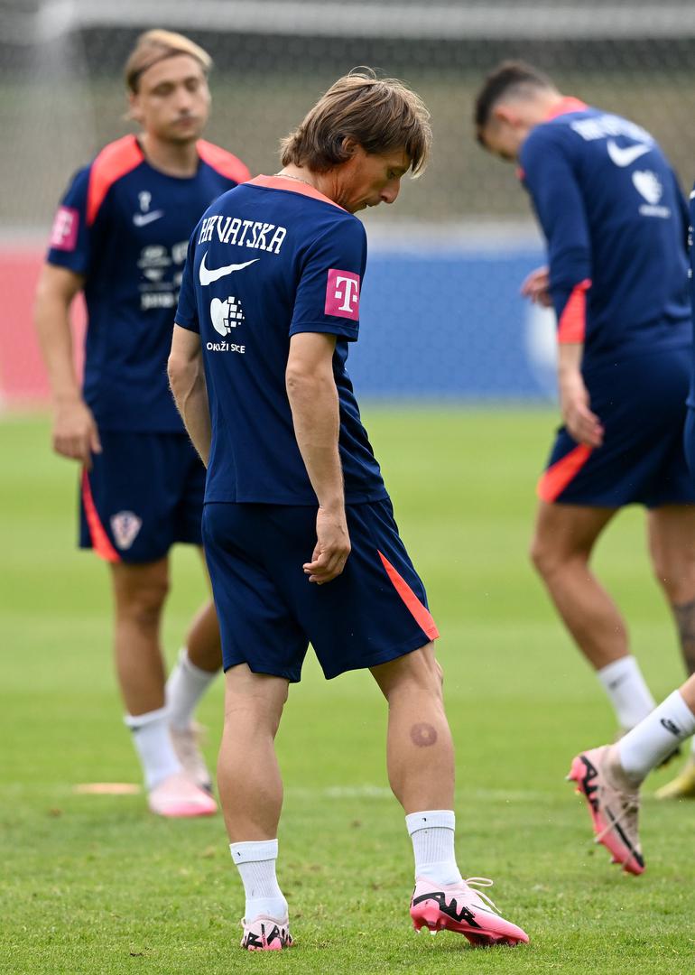 Inače, na treningu reprezentacije pojavio se, dakako, i kapetan Luka Modrić, a na nogama je imao neobične krugove. Oni su posljedica ili hijame ili cuppinga, kako se naziva u zapadnom svijetu. Terapija cuppinga izvodi se postavljanjem čašica na tijelo koje, dok se hlade, stvaraju vakuum te uvlače kožu i mišiće, što privremeno ostavlja tragove kakvi su vidljivi i na Modriću.