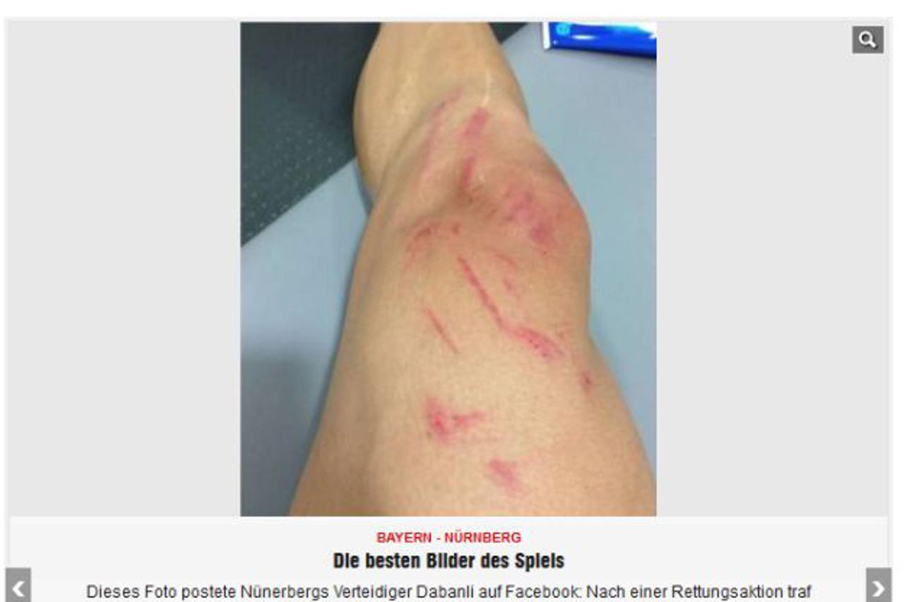 Mandžukić  Dabanli koljeno