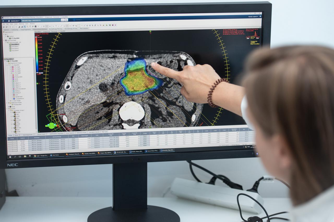 Radiochirurgia Zagreb