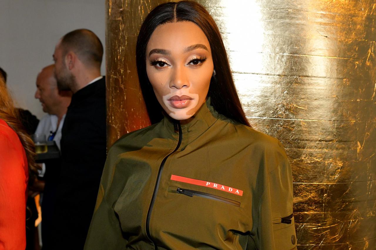 Winnie Harlow