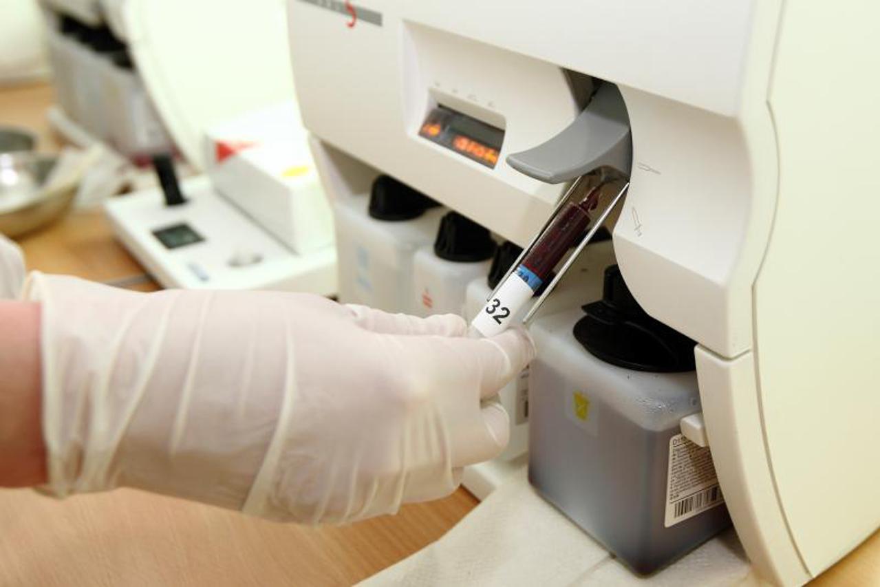 krv, alergije, plinovi u krvi (1)