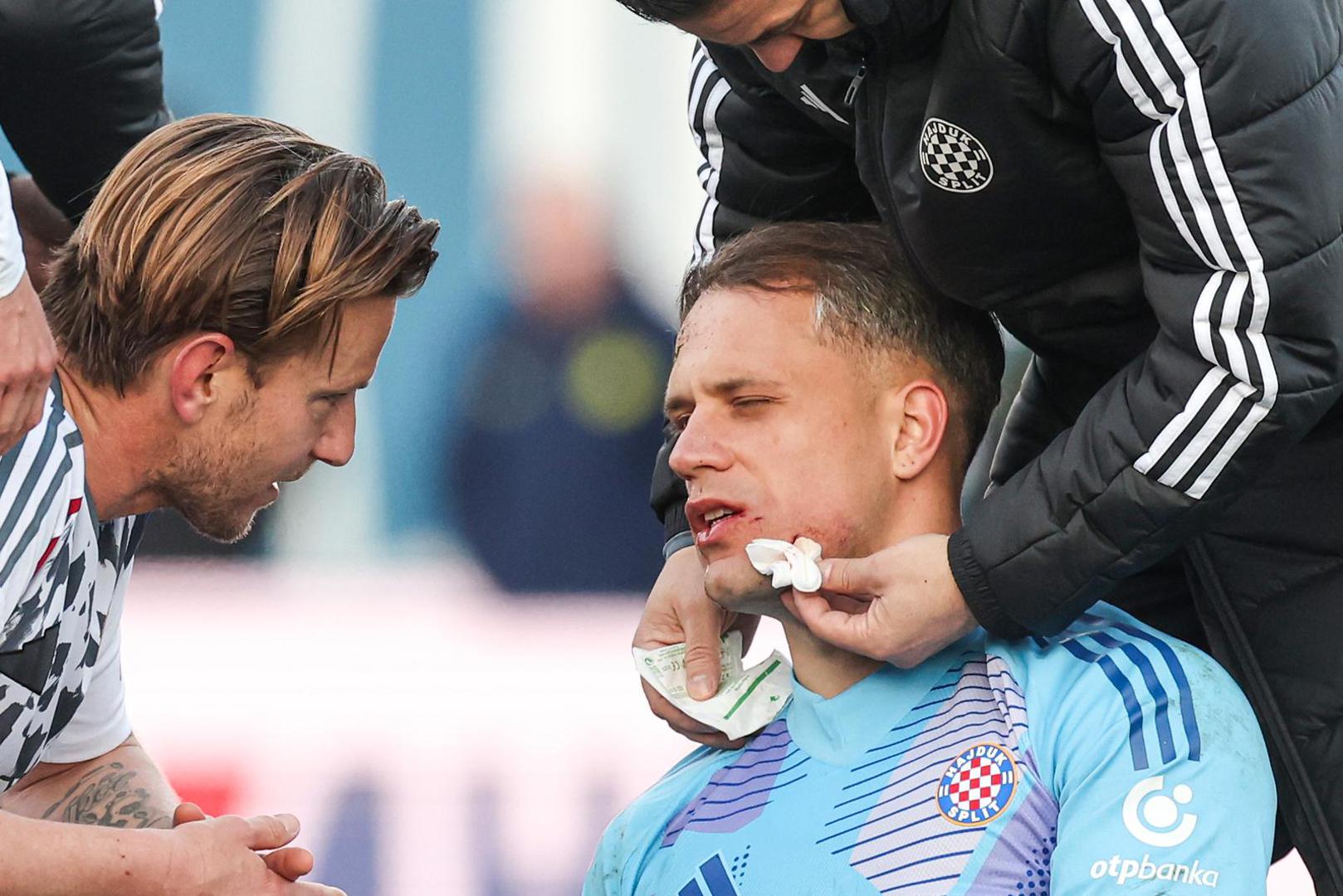 U letu ga je pogodio džonom u lice i nokautirao. Liječnici su morali izaći na teren. Stavili su mu flaster i uspjeli ga nekako osposobiti za posljednje minute susreta.