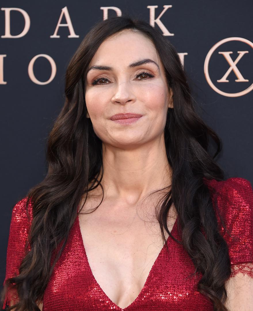  Previše botoksa rezultiralo je time da joj se izraz lica sasvim promijenio i ova 54-godišnjakinja nema više niti jedni boru na licu