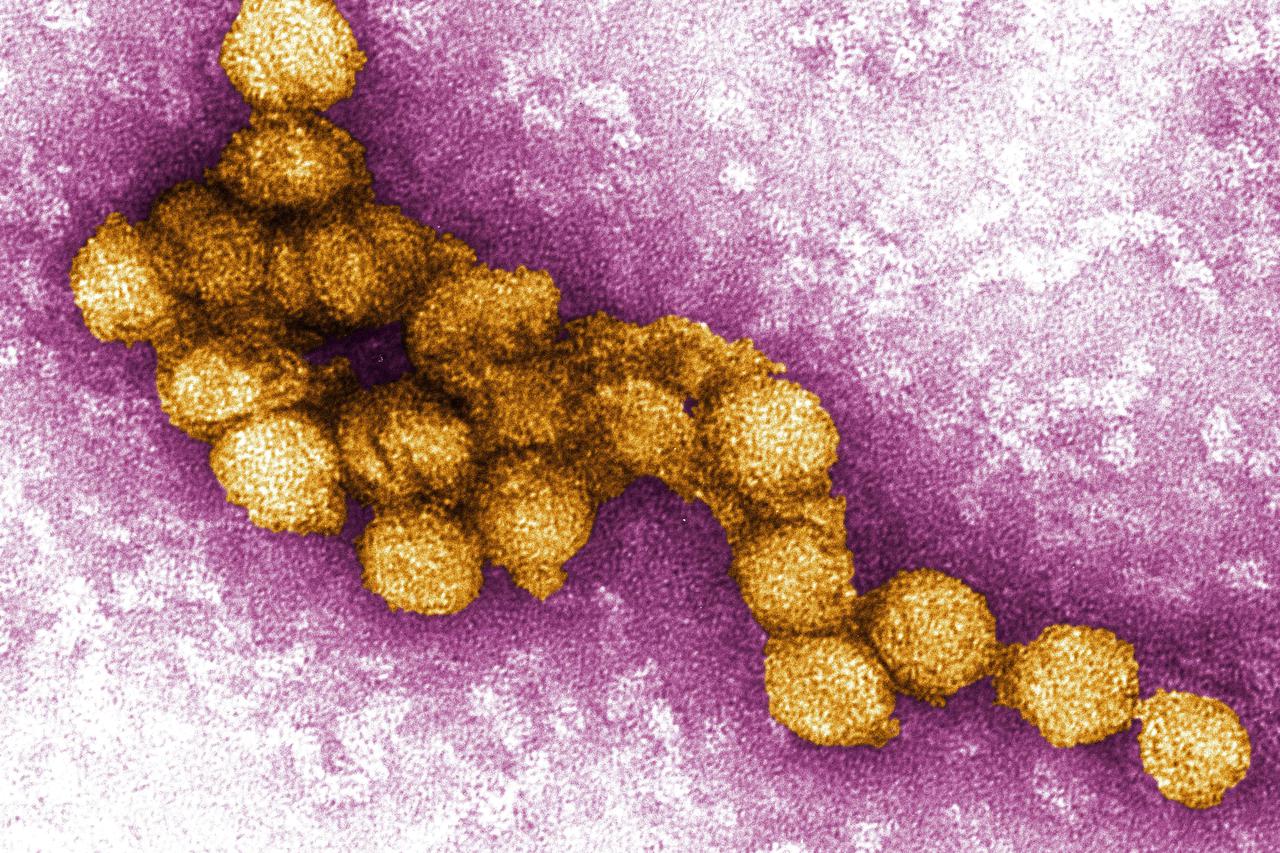 Virus Zapadnog Nila