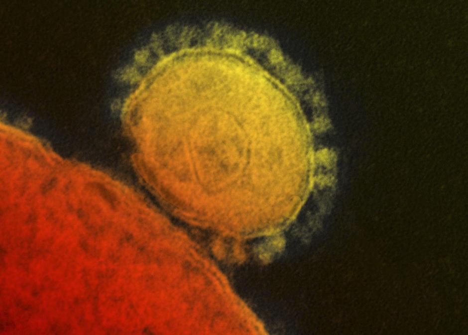 MERS virus