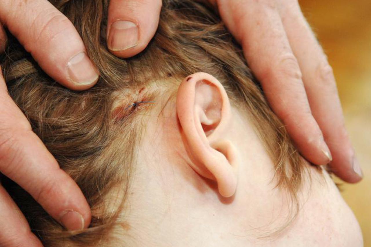 dijete,glava,zatiljak