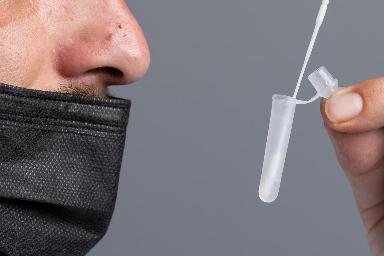 Testiranje kućnim antigenskim testom na covid-19