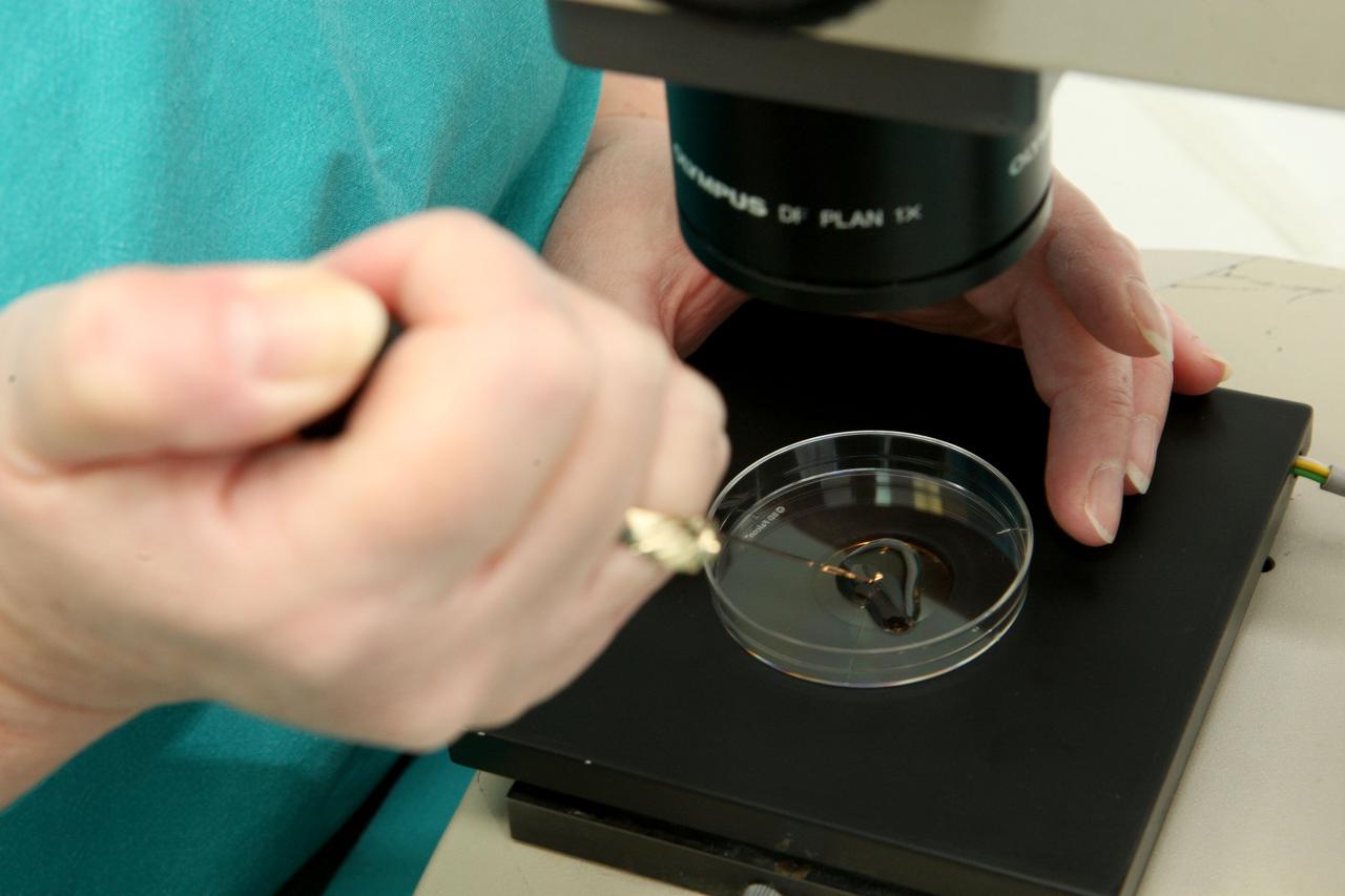 Zagreb: Trudnica u Petrovoj bolnici koja je prva za?ela odmrznutim stanicama