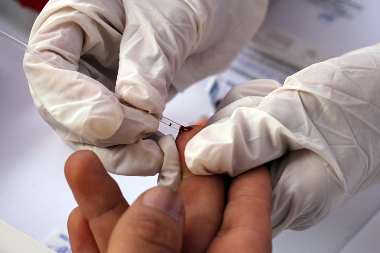 Testiranje na HIV
