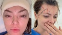 Ella Dvornik Stuns with New Procedures, Reveals Artistic Side