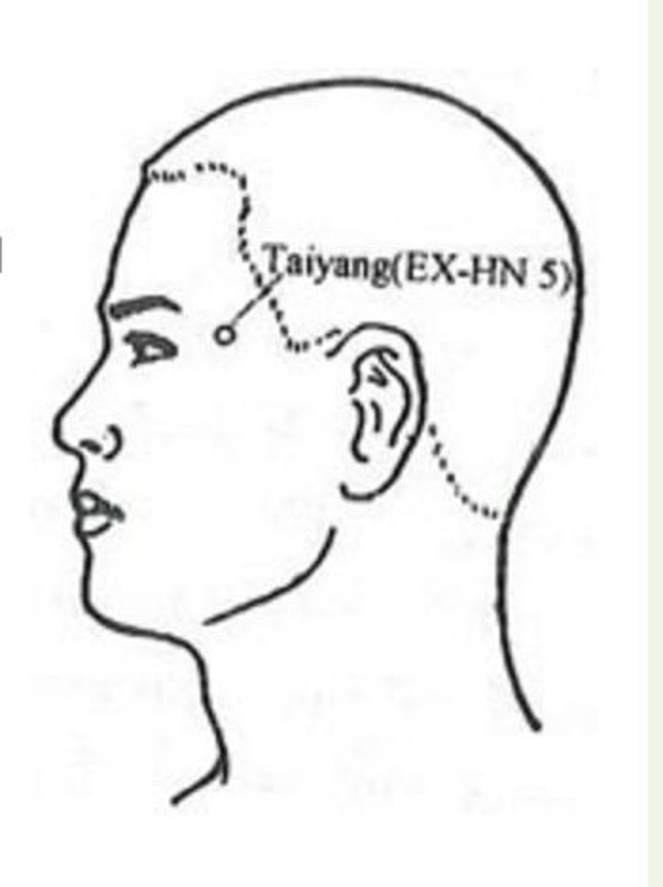 Ilustracija akuprusurne točke