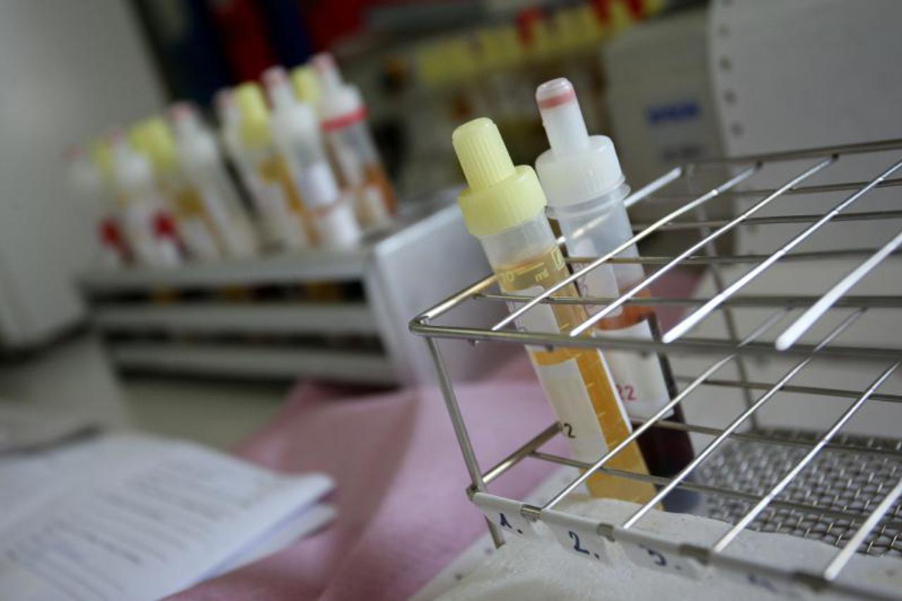 urin,mokraća,portal