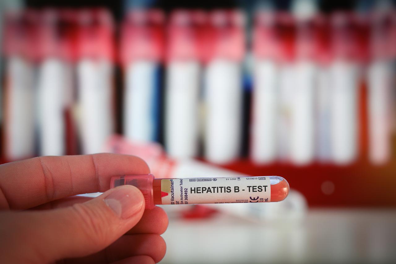Zagonetni porast slučajeva hepatitisa u djece 