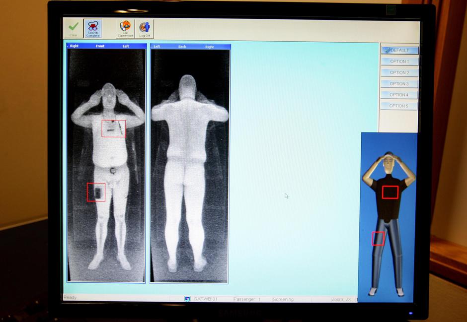 Manchester: Rentgen u zra?noj luci koji "vidi" i kroz odje?u