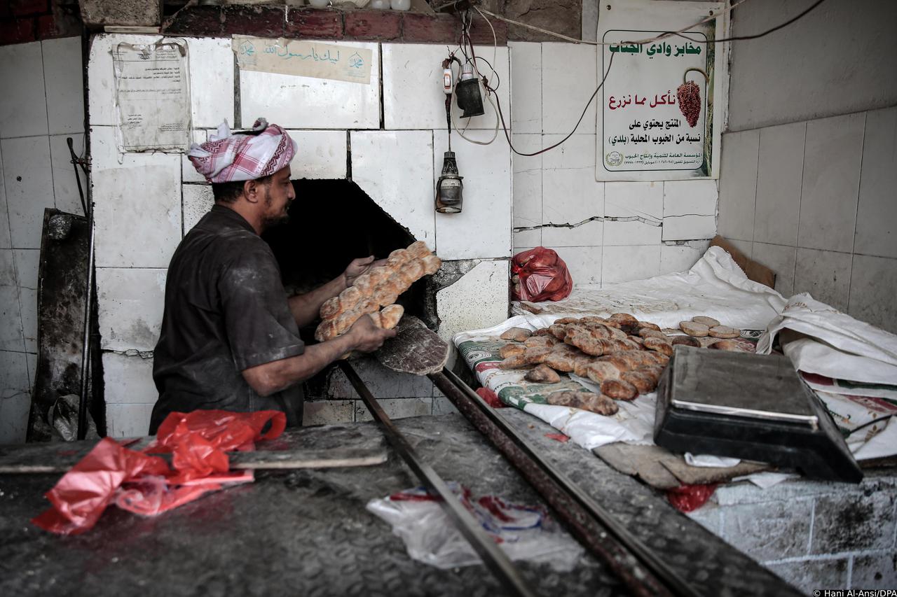 Ukraine conflict worsens Yemen hunger crisis