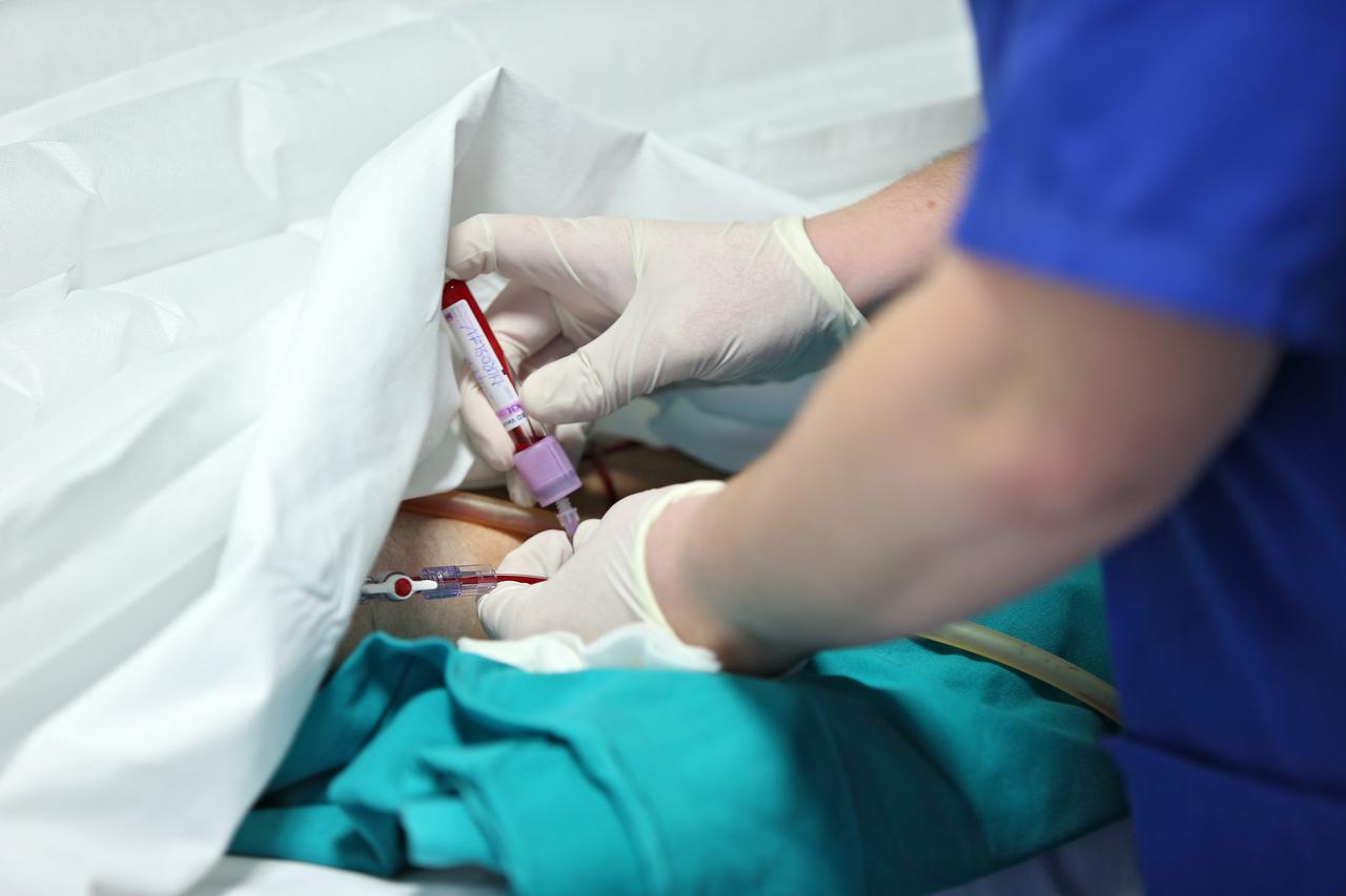 Zagreb: Odjel kardijalne anestezije u KBC Dubrava