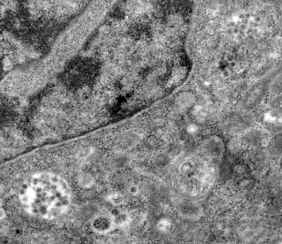 Virus je ušao u citoplatmu gdje može početi s repliciranjem (svijetlije polje dolje lijevo)