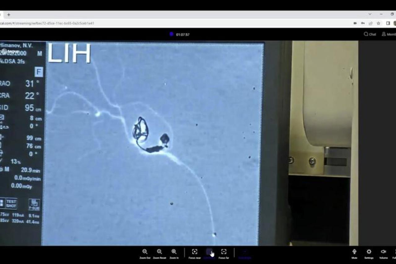 Operacijski zahvat ukrajinskih liječnika