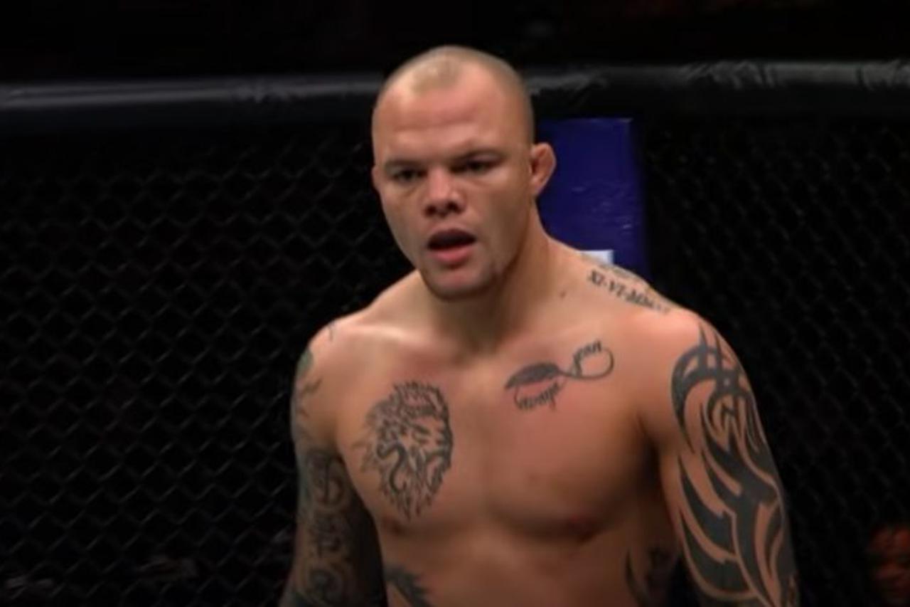 Anthony Smith